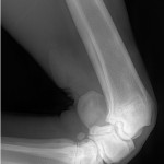 xray2
